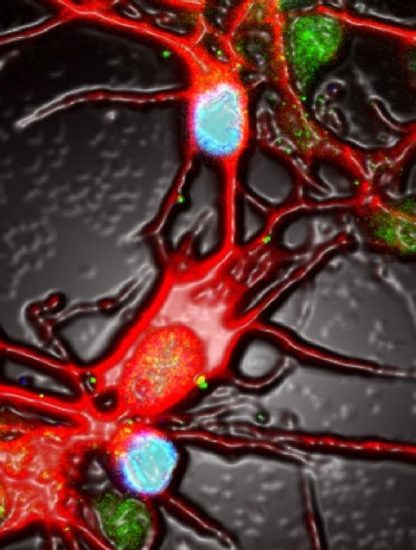 neurones activite depression