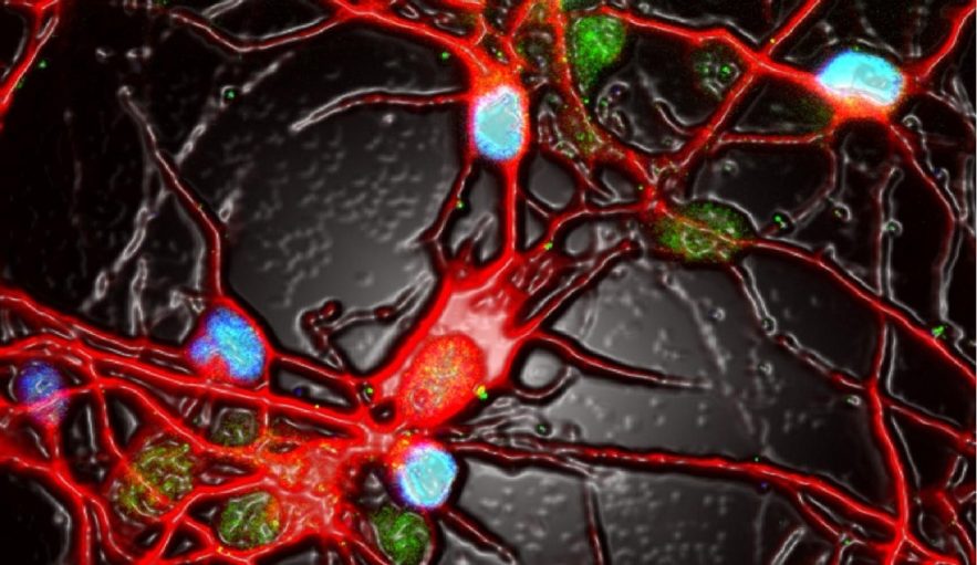 neurones activite depression