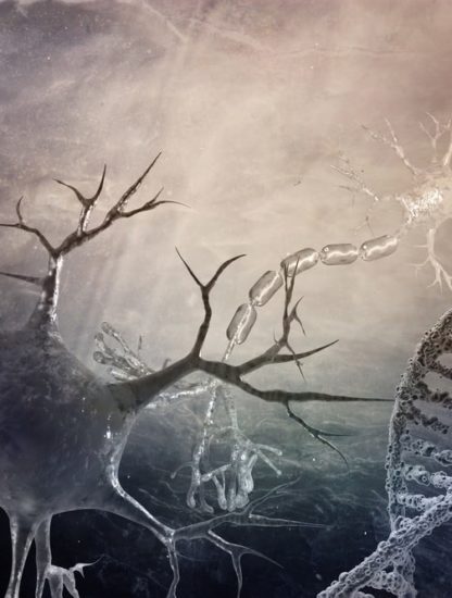 neurones maladies alzheimer