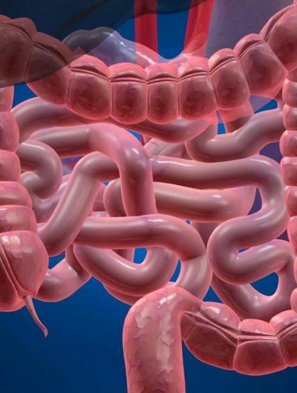 cancer colorectal