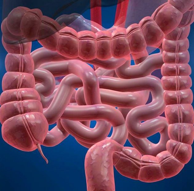 cancer colorectal