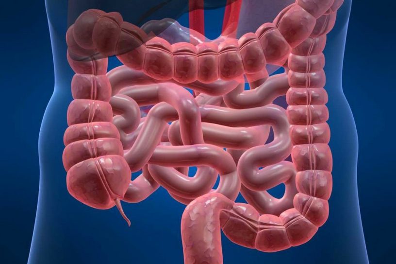 cancer colorectal