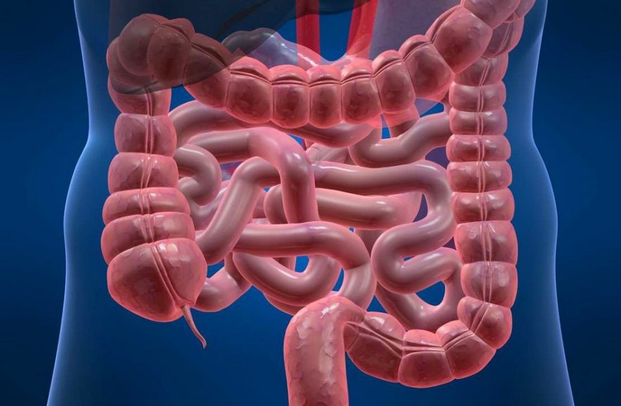 cancer colorectal