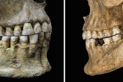 dents machoire labiodentales