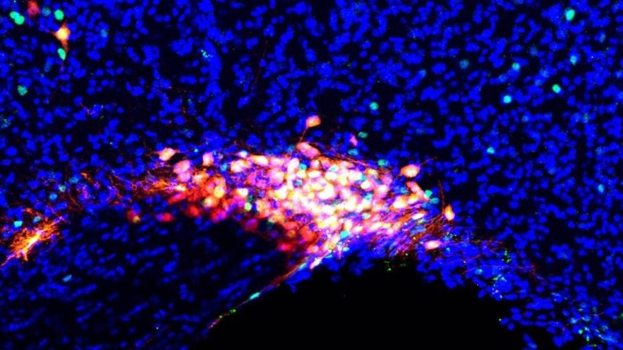 anesthesie generale neurones