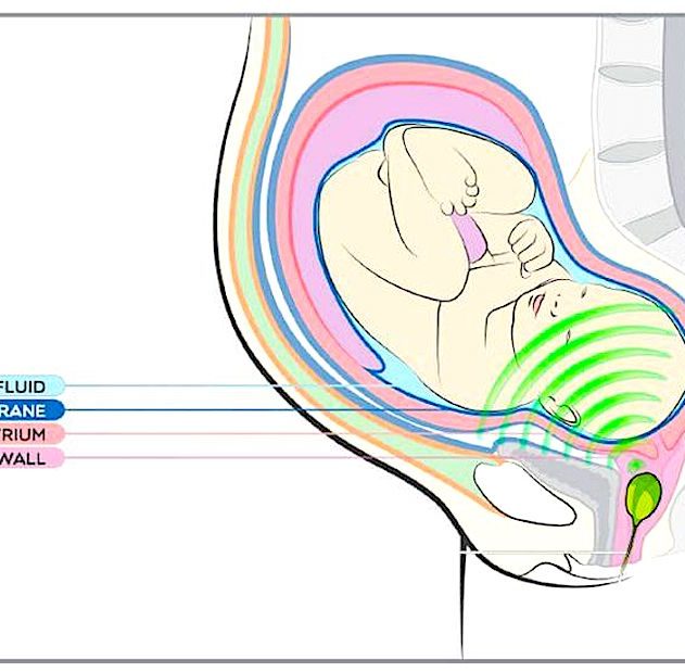 babypod schema