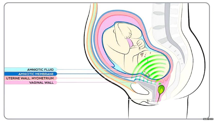 babypod schema