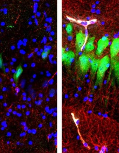 cellule mort cerebrale