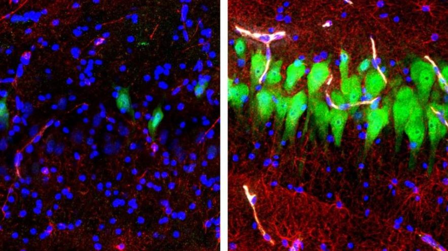 cellule mort cerebrale