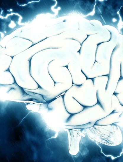 cerveau-stimulation-electrique