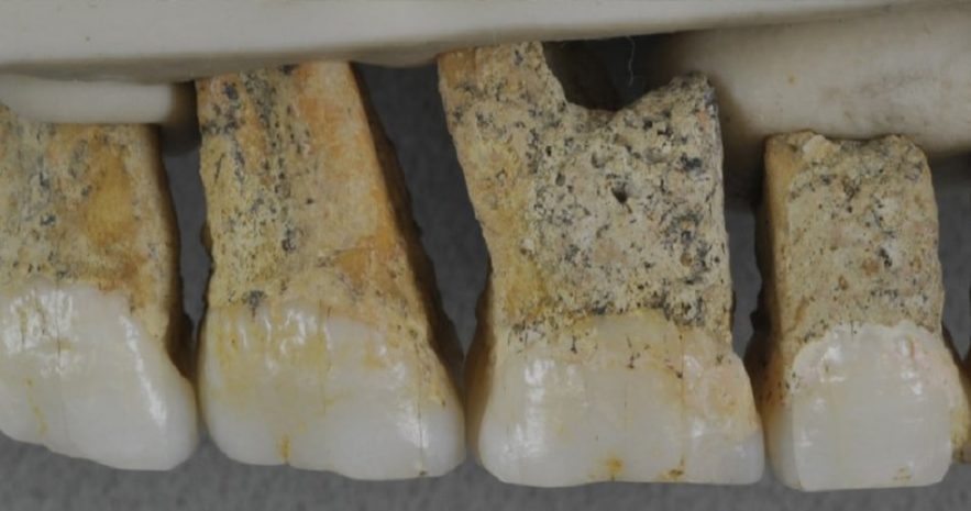 dents homo luzonensis