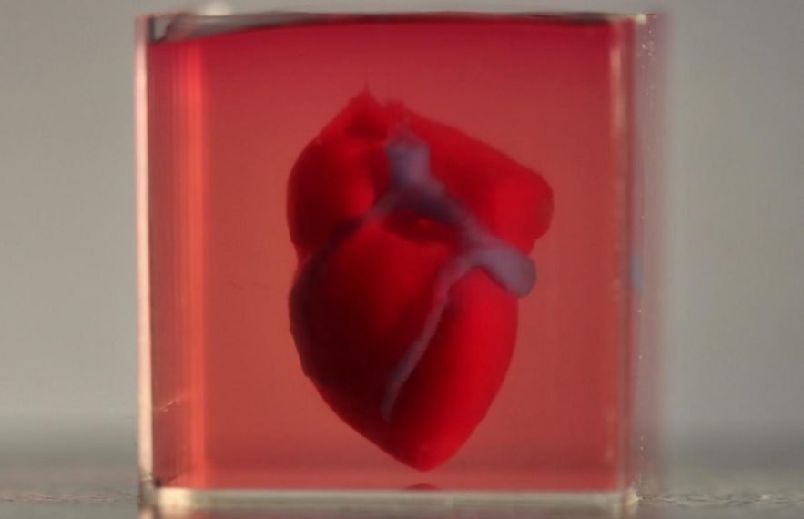 impression 3d coeur