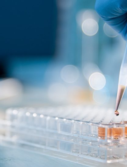 laboratoire fioles
