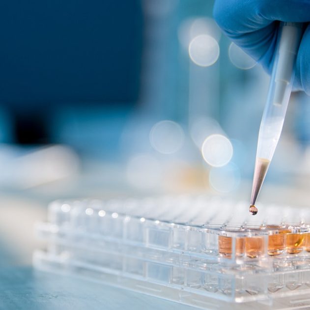 laboratoire fioles