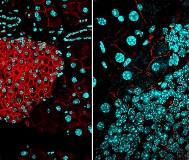 cellules cancereuses barriere