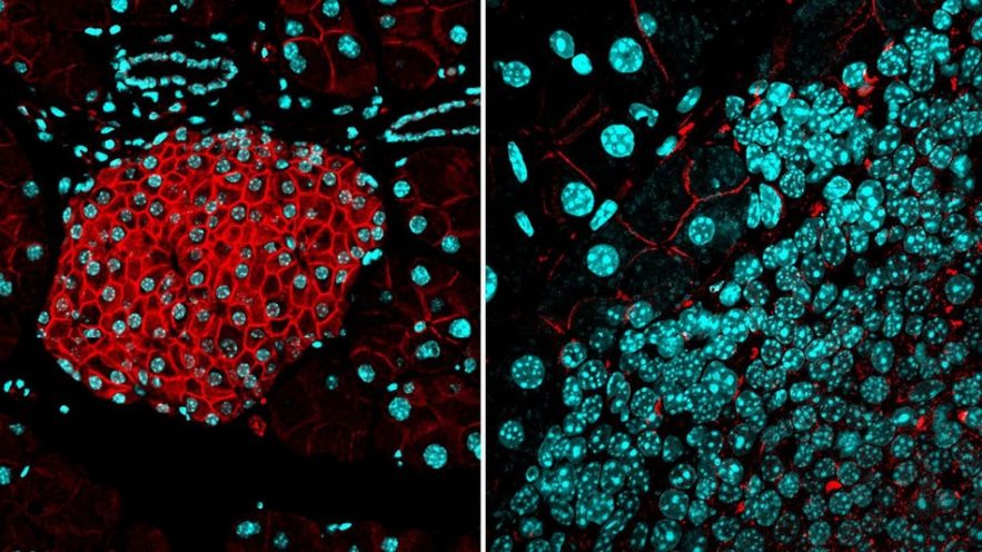 cellules cancereuses barriere