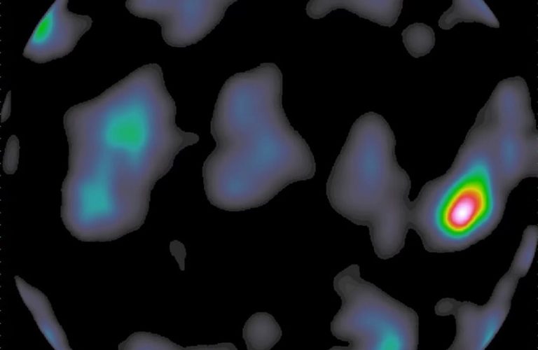 image sursaut gamma