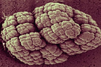 bacterie keinococcus radiotolerans