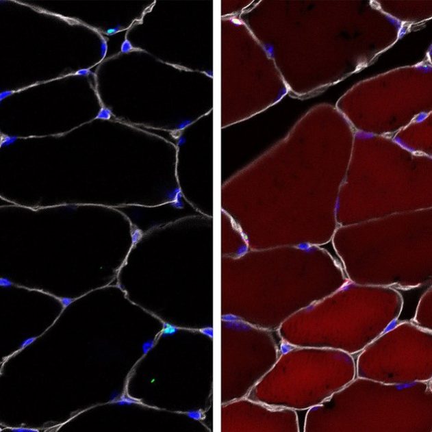 cellules souches modifies genetiquement