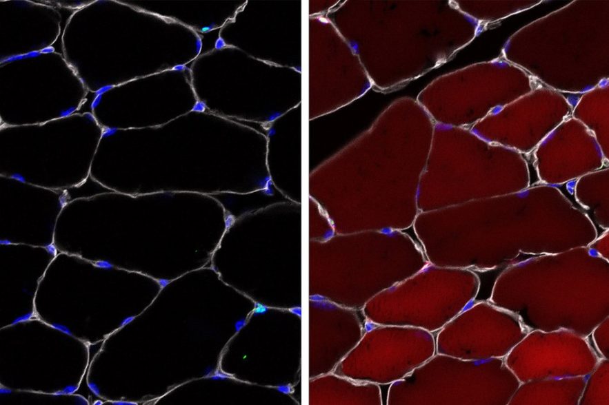 cellules souches modifies genetiquement