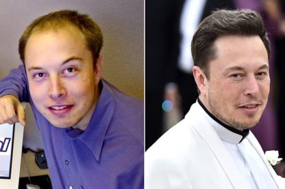 transplantation avancees et techniques musk