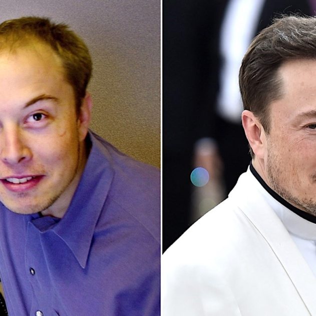 transplantation avancees et techniques musk