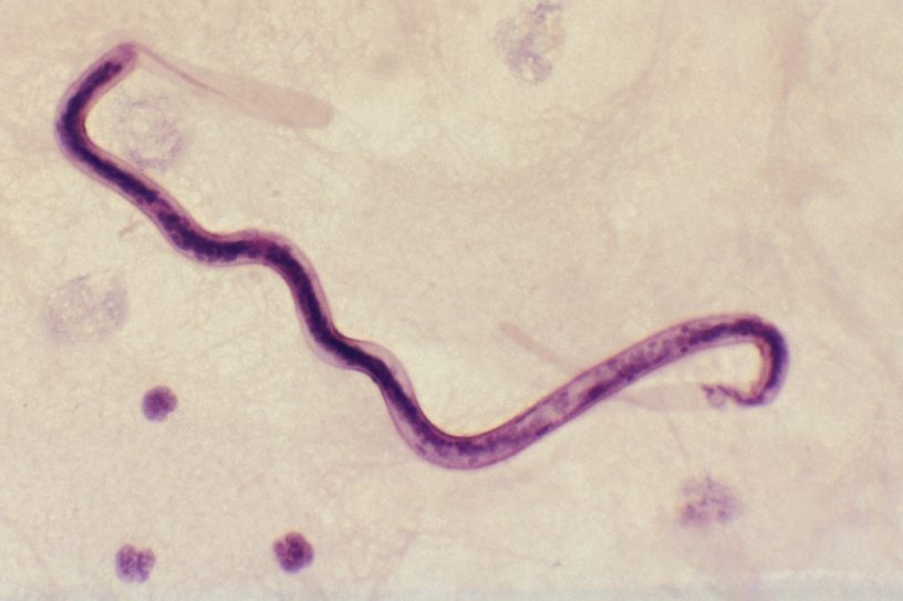 ver parasitaire
