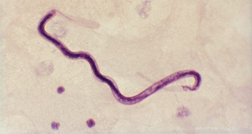 ver parasitaire