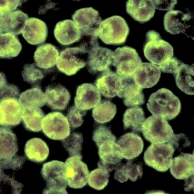 tissu infecte par naegleria fowleri