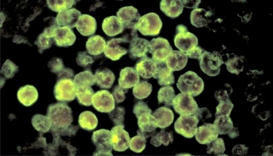 tissu infecte par naegleria fowleri