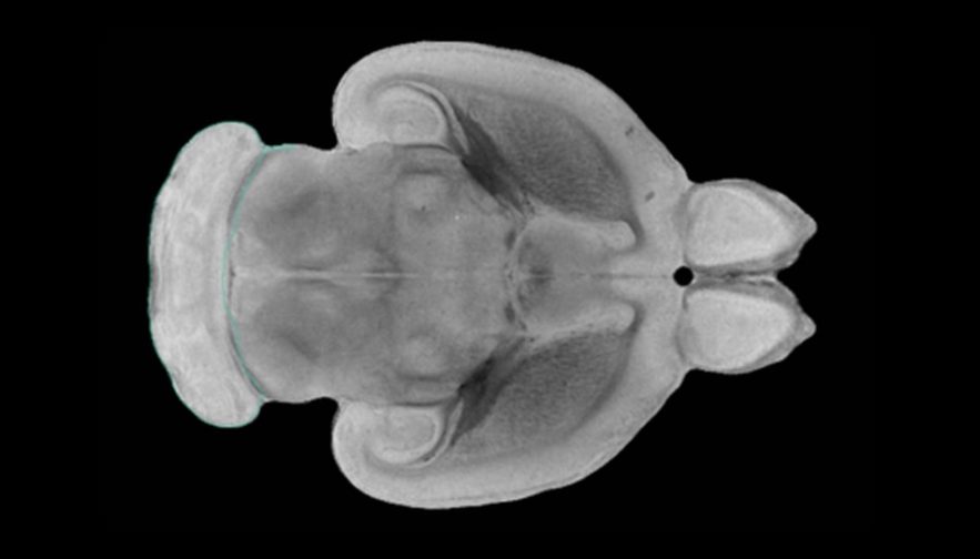cerveau rat cellule souche