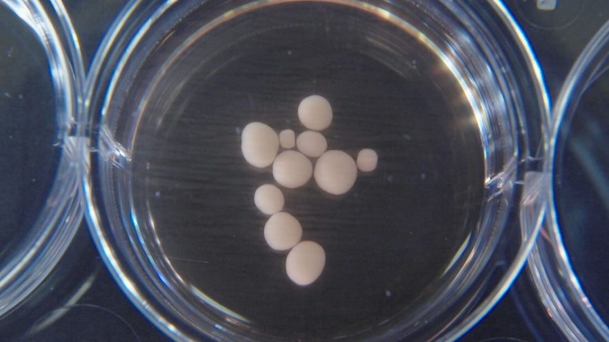 cerveau laboratoire cellules souches cellule
