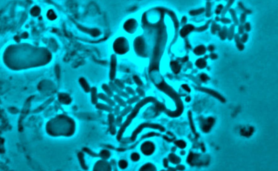 potentielle cause resistance antibiotiques identifiee