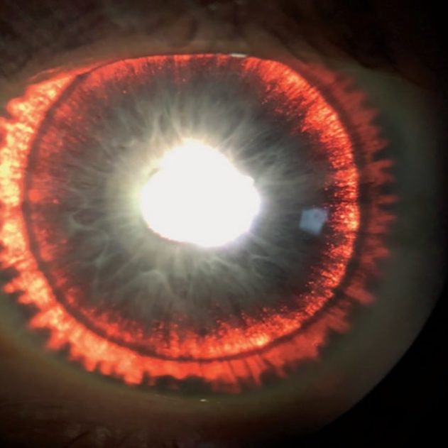 iris brillant
