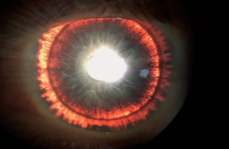 iris brillant