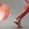 tendons muscles
