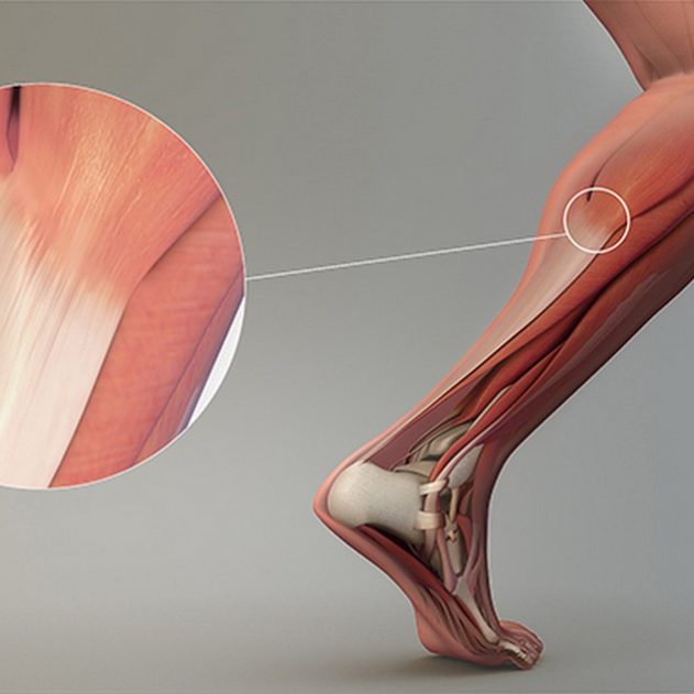 tendons muscles