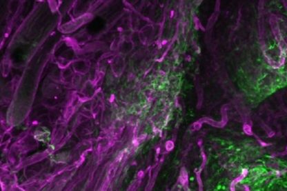 formation cicatrices