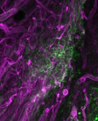 formation cicatrices