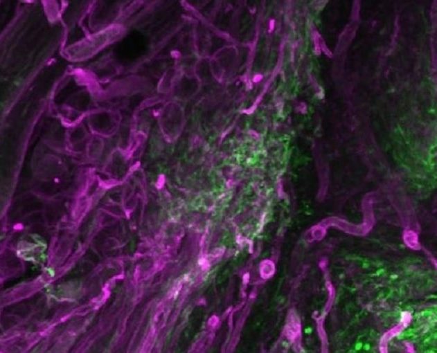 formation cicatrices
