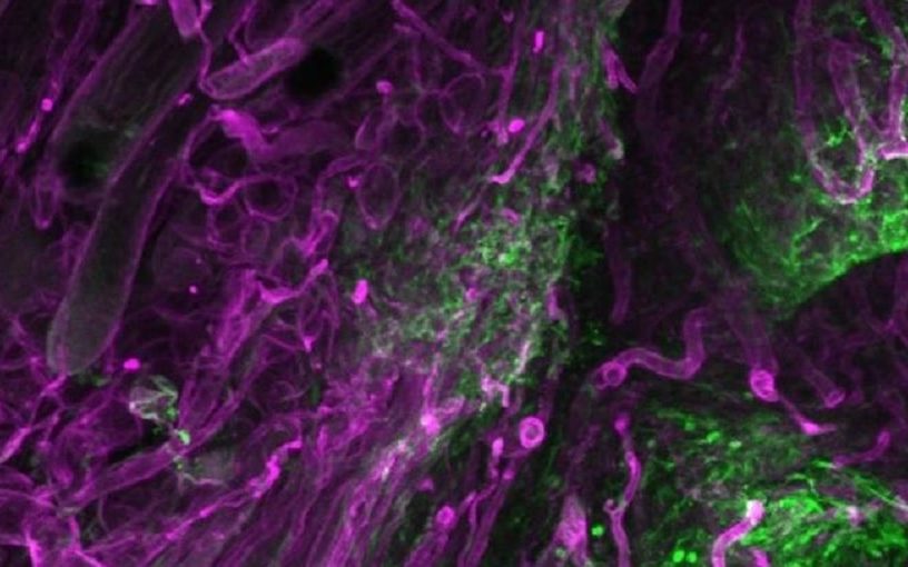 formation cicatrices