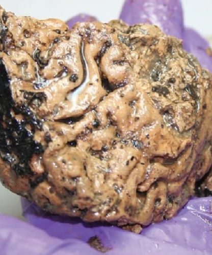 cerveau preservation