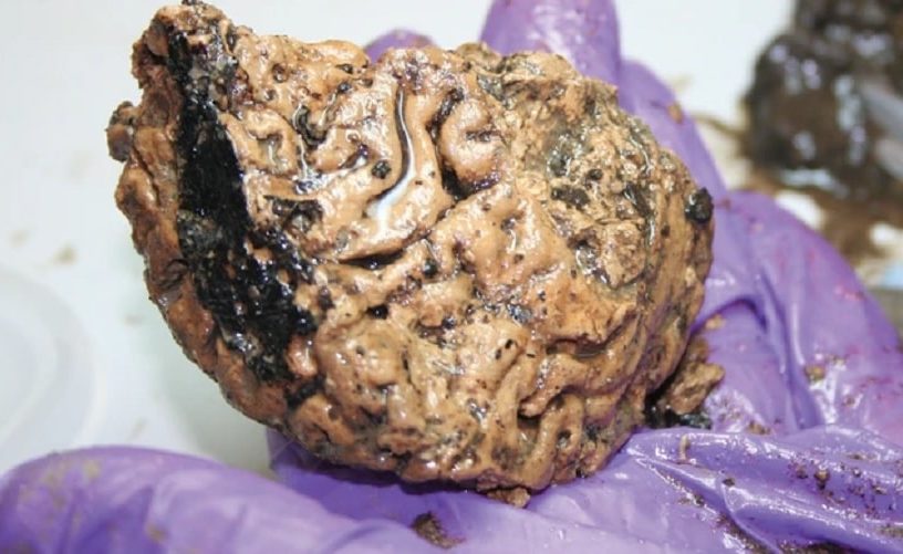 cerveau preservation