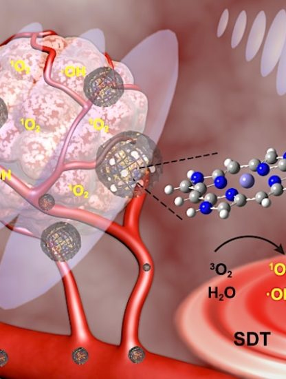 traitement cancer ultrason methode sonodynamique