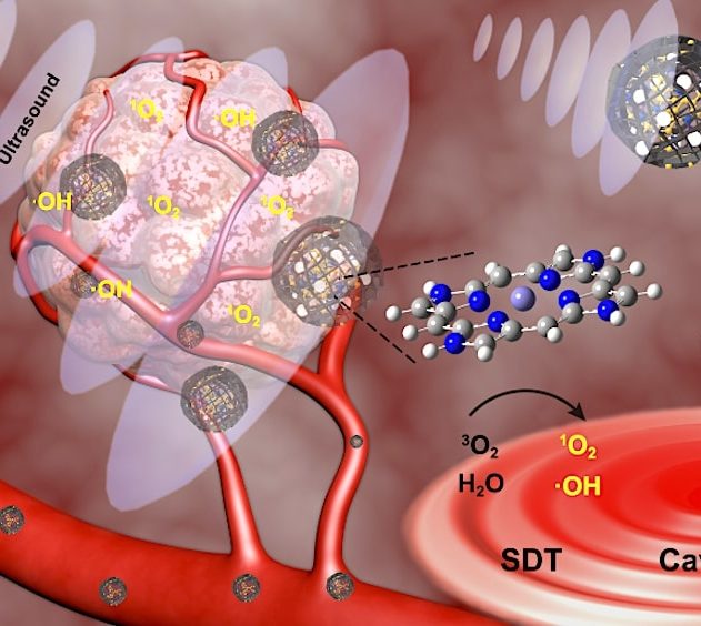 traitement cancer ultrason methode sonodynamique