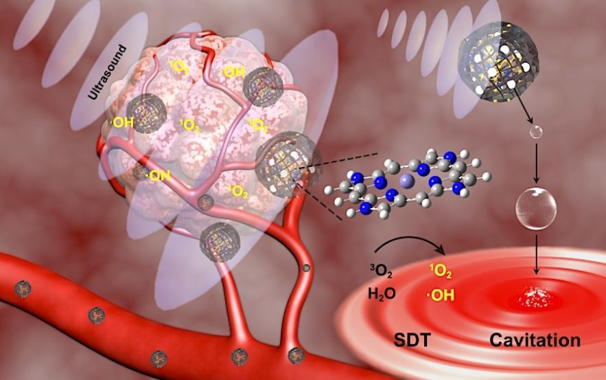 traitement cancer ultrason methode sonodynamique