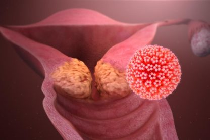 elimination hpv