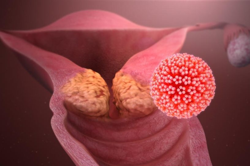 elimination hpv