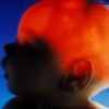 cerveau manquant partie hemisphere gauche