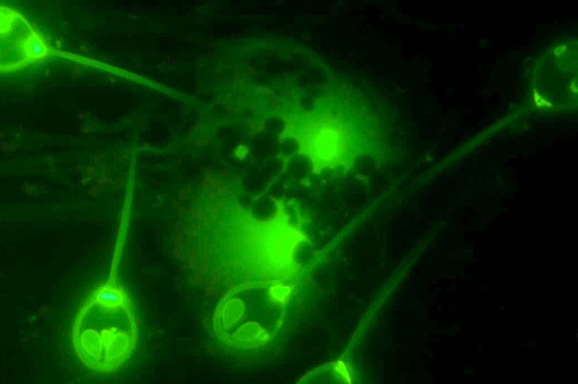 parasite survie sans oxygene henneguya salminicola